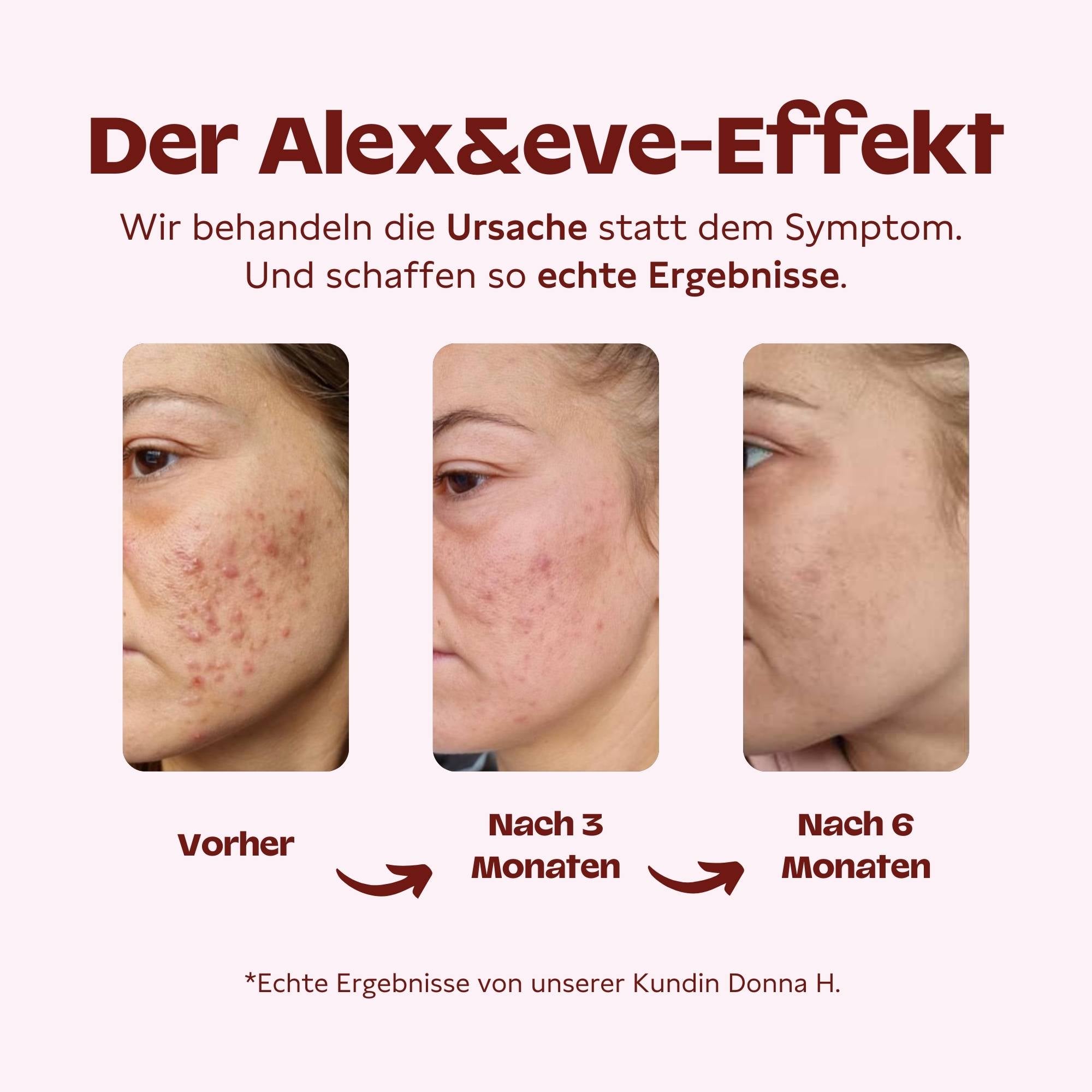 Haut Helfer Starterset