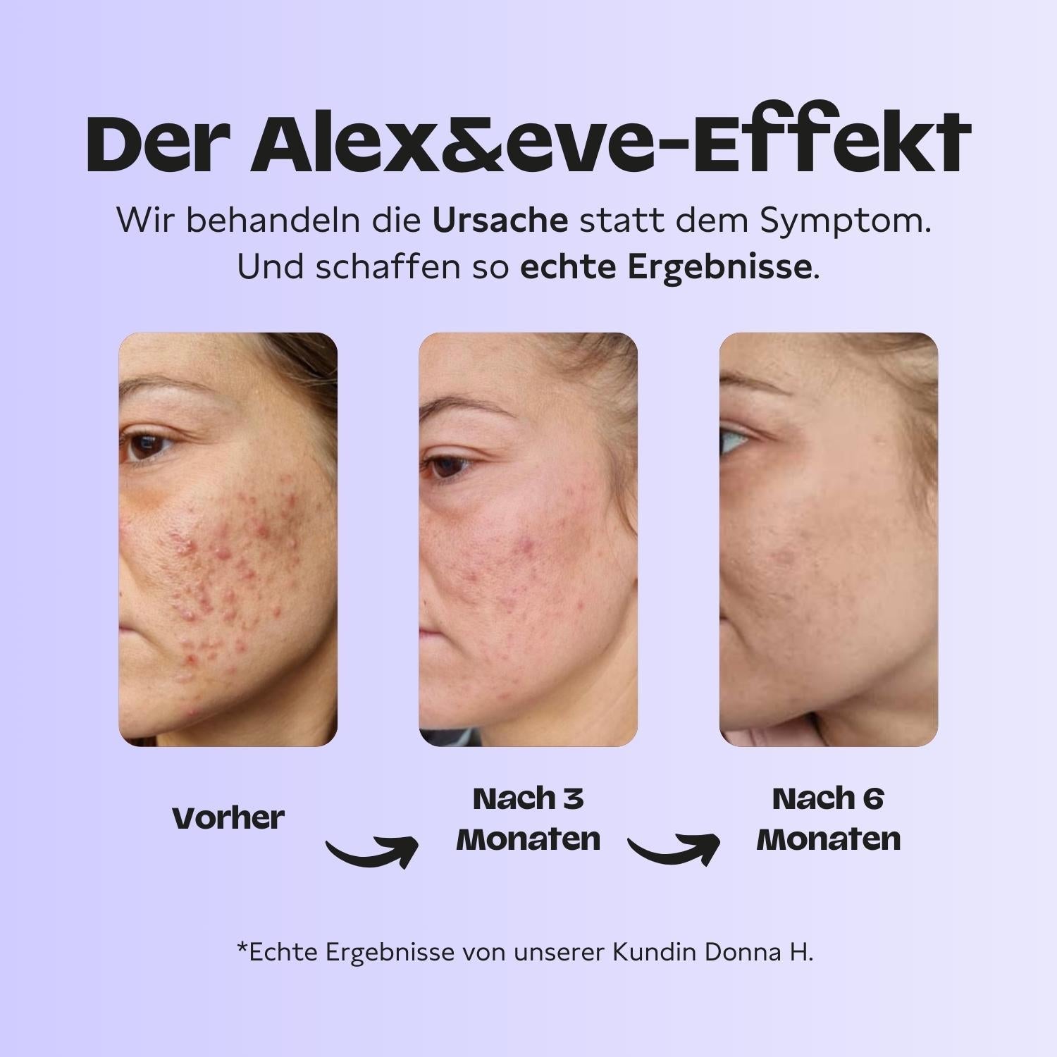 Hormon Harmonie Starterset - Alex&eve