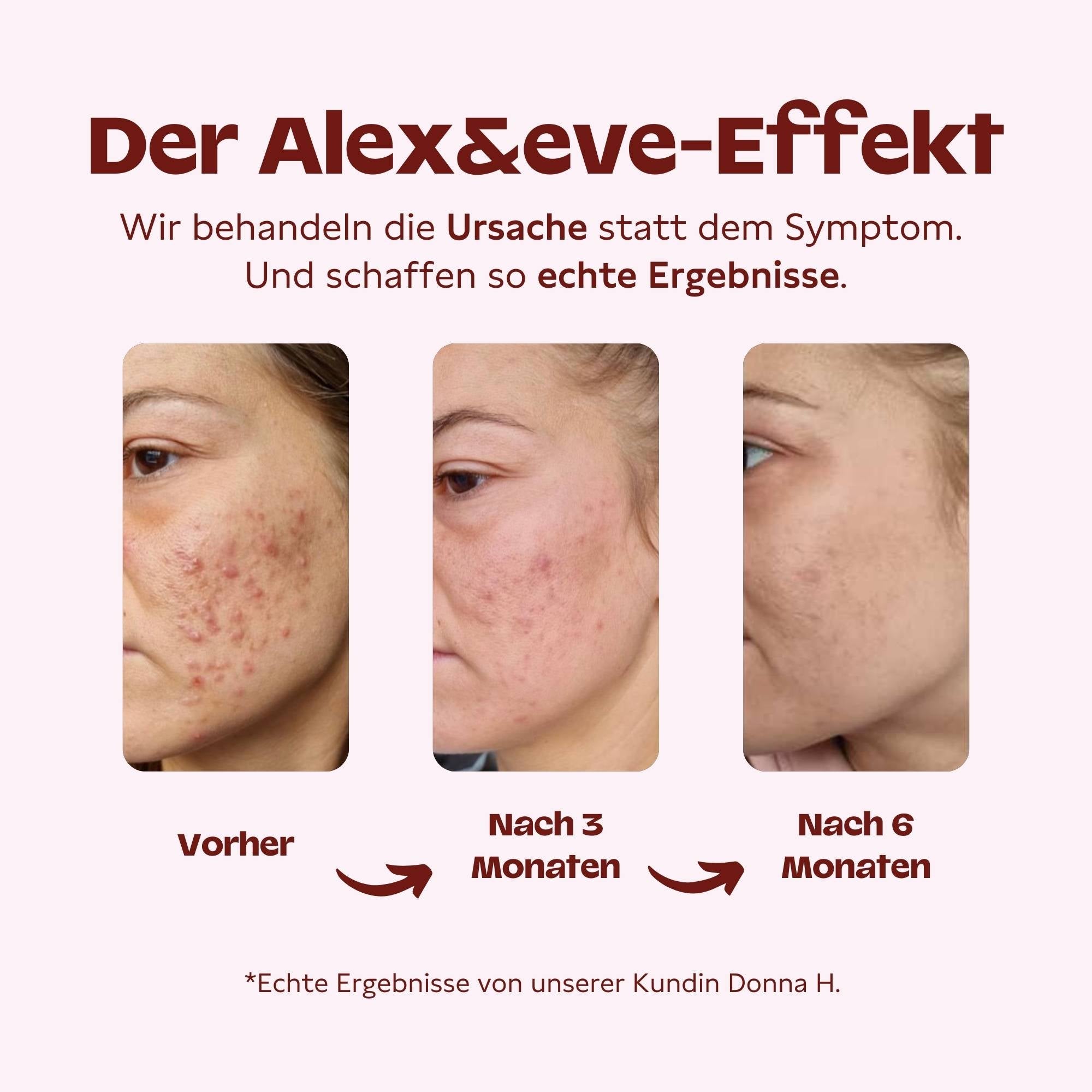 Haut Helfer Starterset - Alex&eve