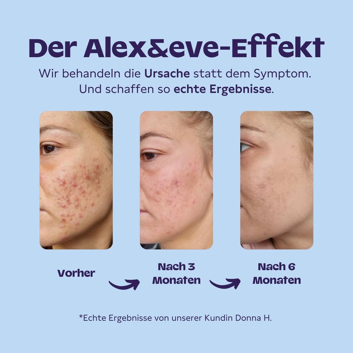 Haut Hormon Paket - Alex&eve